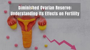 Diminished Ovarian Reserve