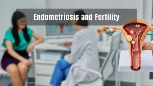 Endometriosis and Fertility