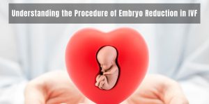 Embryo Reduction