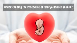 Embryo Reduction