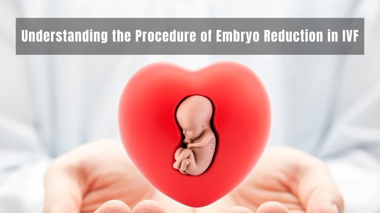 Embryo Reduction